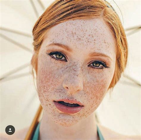 nude freckles|freckles Search